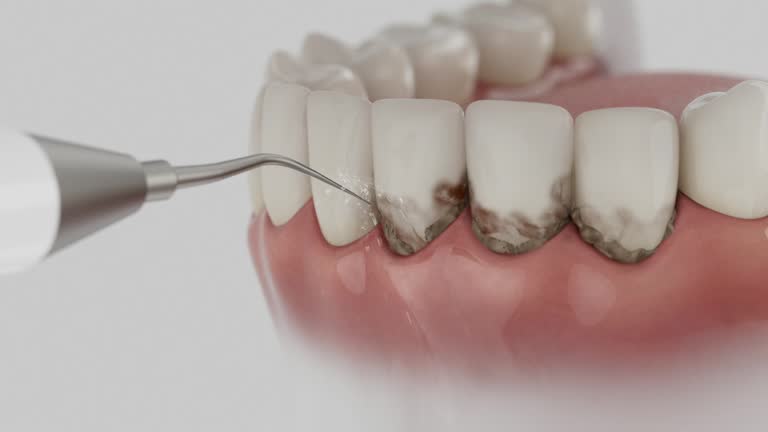 Reliable Dental contractor in Park Layne, OH by Dentist Open Now